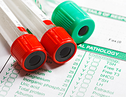 Hepatitis C: What you need to know