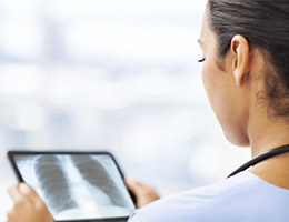 Lung cancer: 10 must-know facts